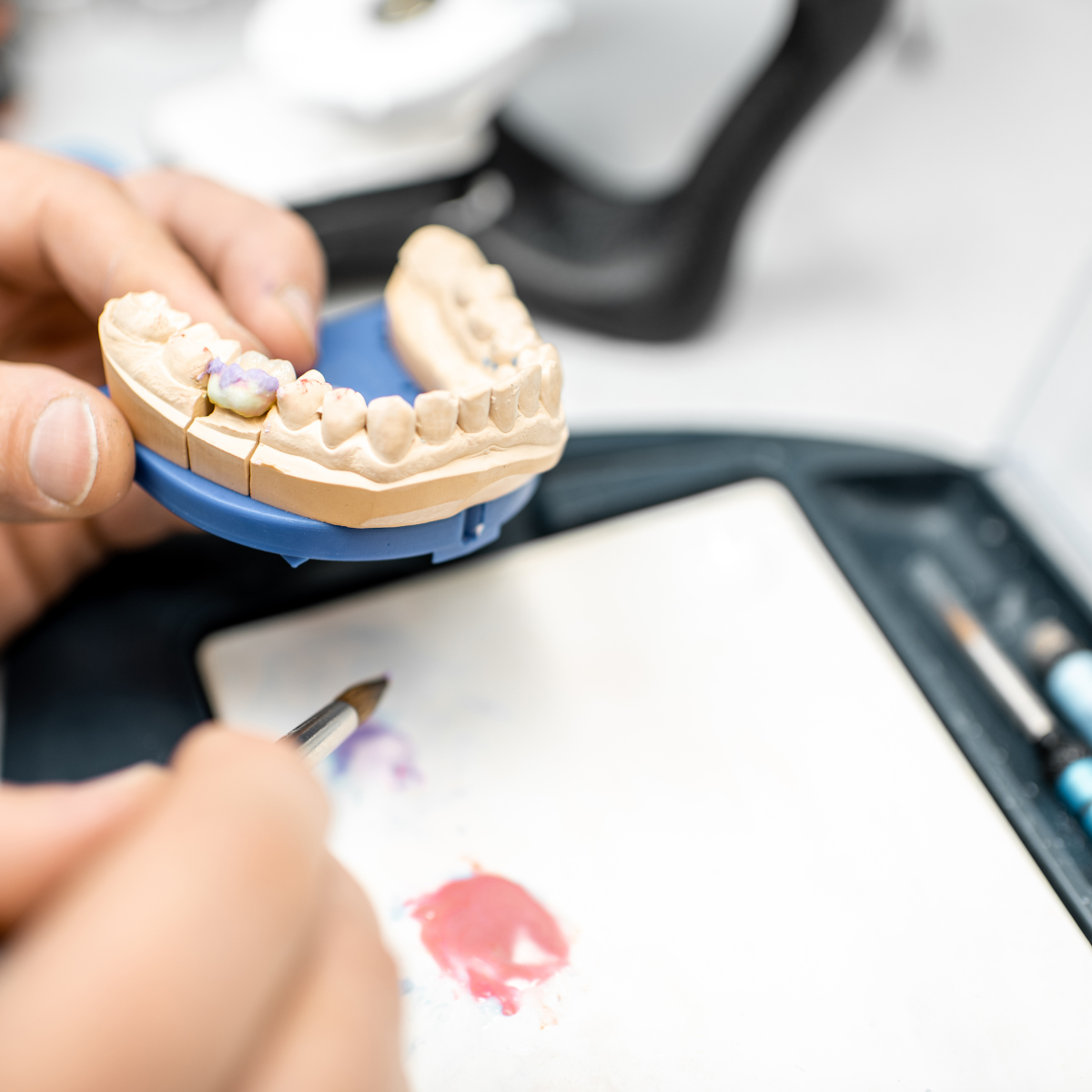 Protesi dentali in ceramica e zirconia